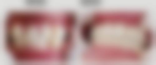 盐池宥艺口腔诊所治疗反馈与口碑评价。