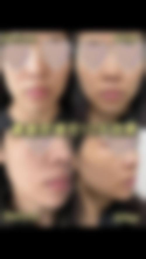 福州云朵美人整形医院地理位置便于到院。