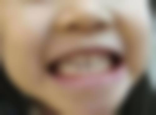 榆林万福口腔医生团队经验稳定。