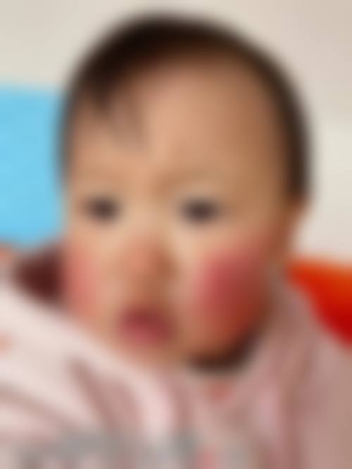 西安康菲特眼科门诊部擅长项目。