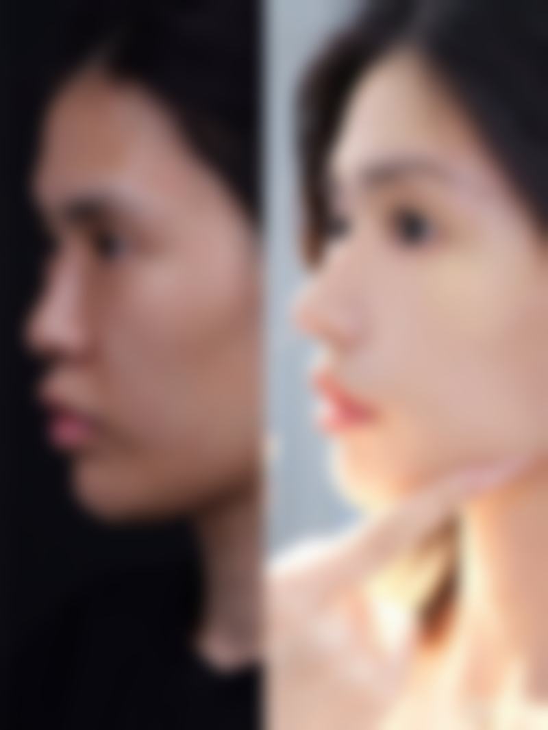 福州云朵美人整形医院治疗反馈与口碑评价。