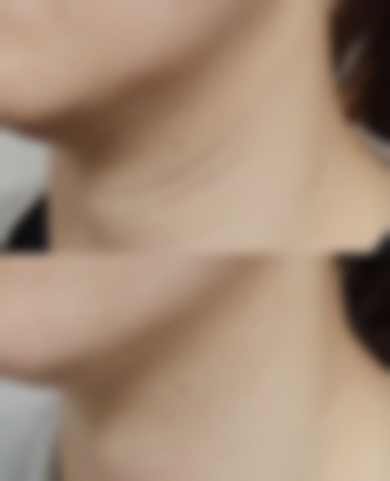 福州云朵美人整形医院擅长项目。