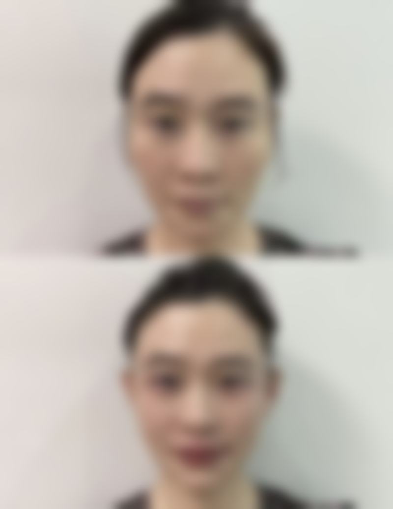孟亚秀医生技术或实力
