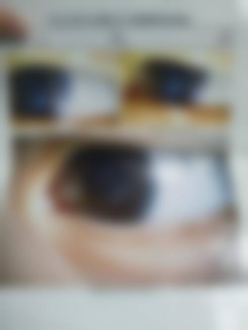 昆明阿玛施眼科门诊部预约挂号方式。