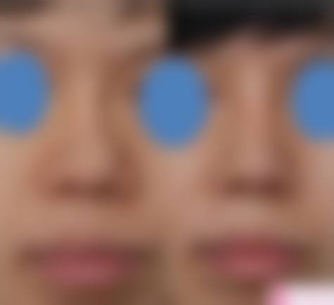 北京贝拉整形医疗美容诊所擅长项目。
