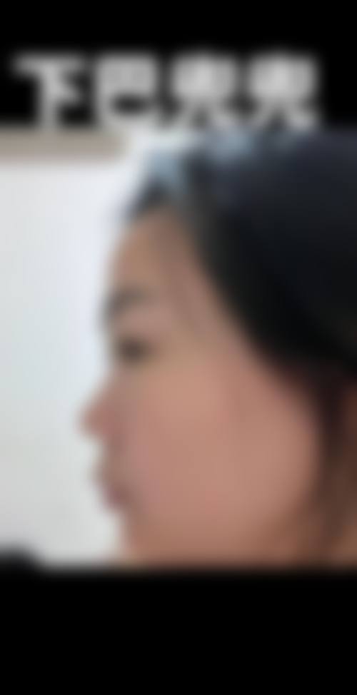 郑州徐锐峰医疗美容诊所擅长项目