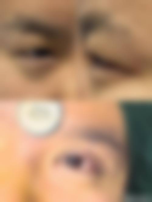 郑州市第九人民医院眼科医生团队经验稳定。
