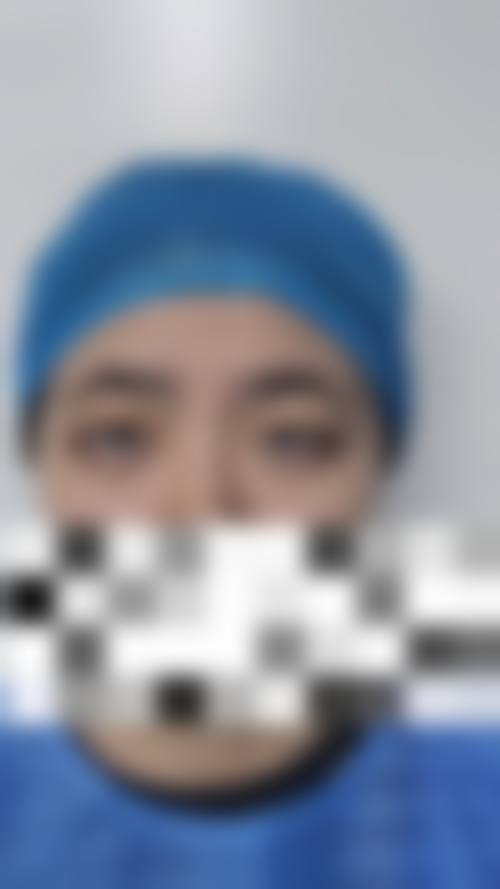 郑州市第九人民医院眼科治疗反馈与口碑评价。