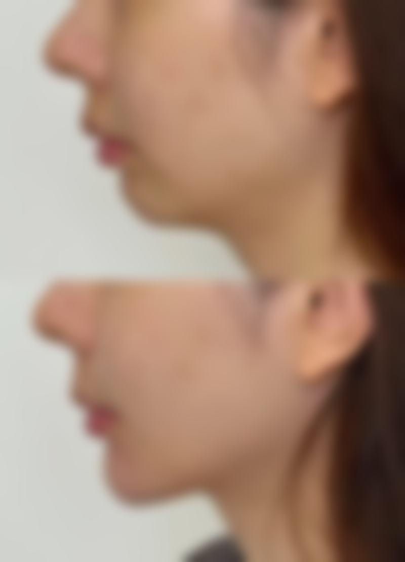 杨士常医生擅长项目介绍