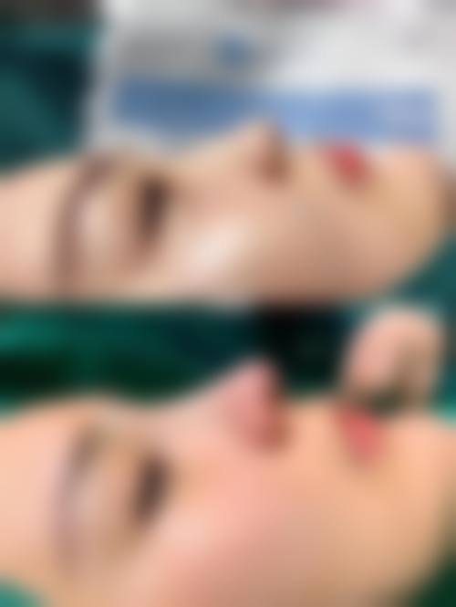 台州爱美美莱医疗美容门诊部治疗反馈与口碑评价。