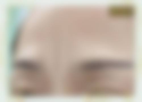台州爱美美莱医疗美容门诊部2026年价格收费表：