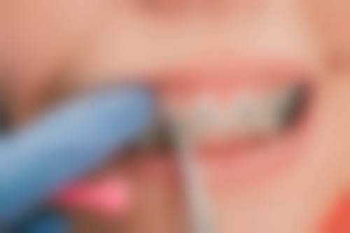 浙江衢州裴宇红口腔特色诊疗项目与技术优势