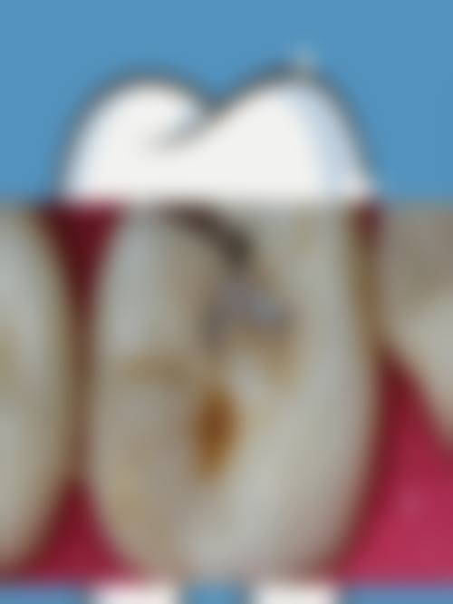 邵阳映祥口腔预约挂号方式。