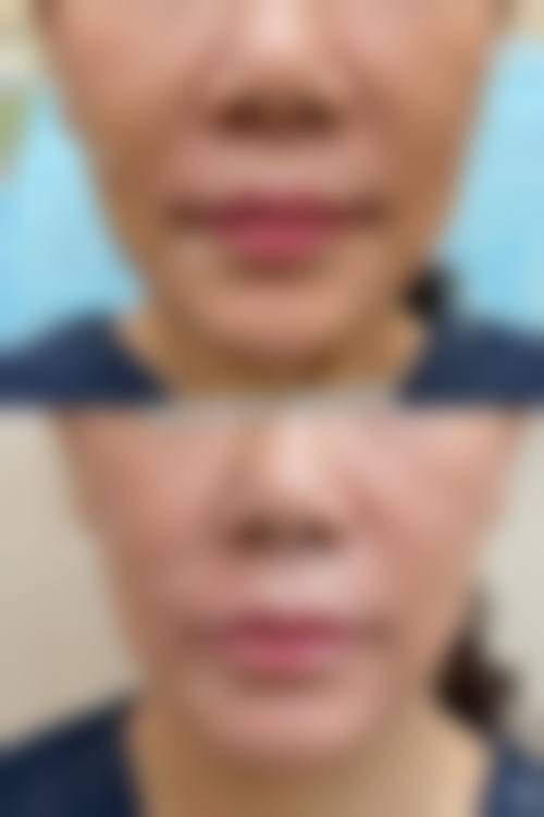 济宁市第二人民医院治疗反馈与口碑评价。
