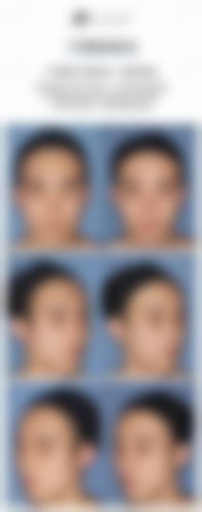 Julia医生擅长项目多样