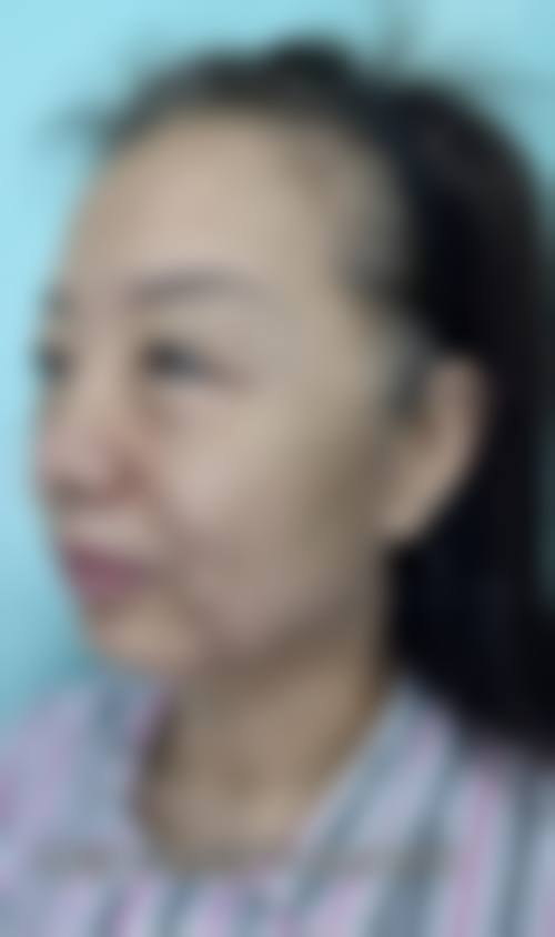 台州爱美美莱医疗美容门诊部预约挂号方式。