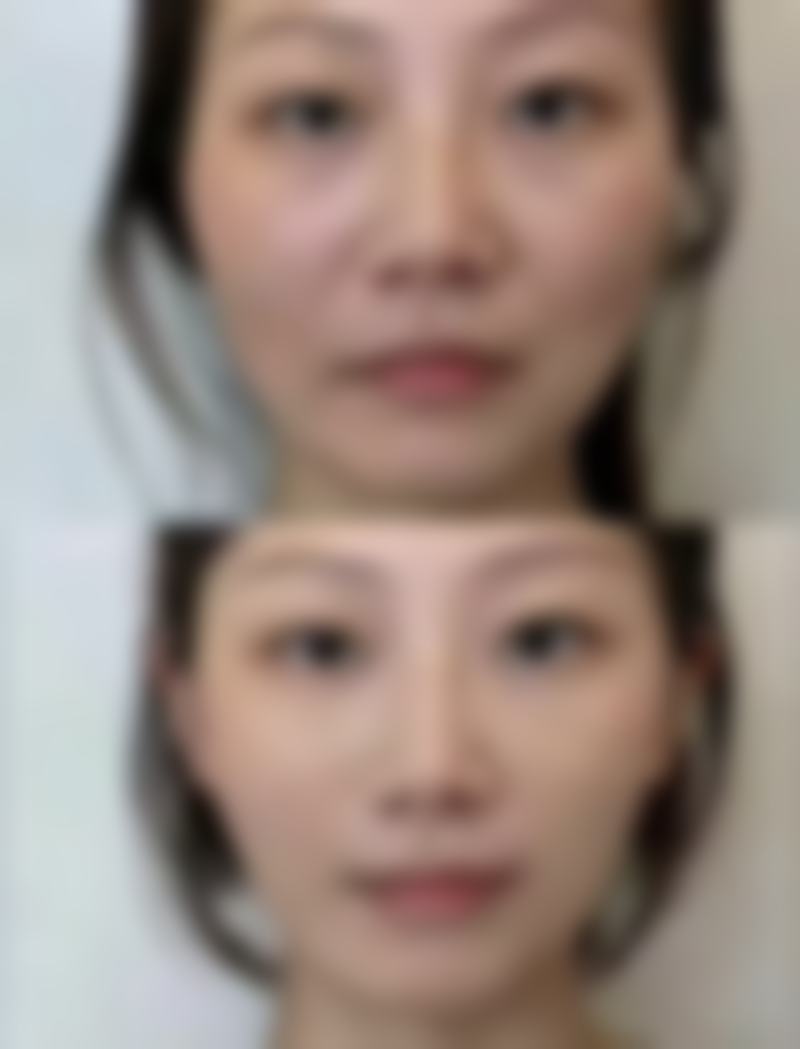 Julia医生技术实力出色