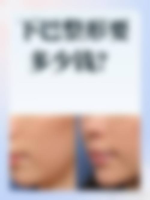 杜永忠医生擅长项目