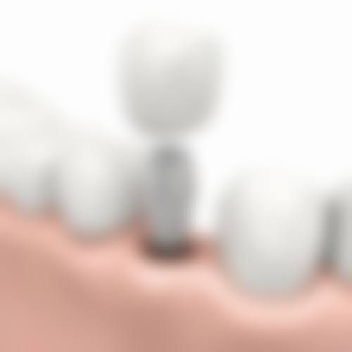 刘登丰医生技术优势