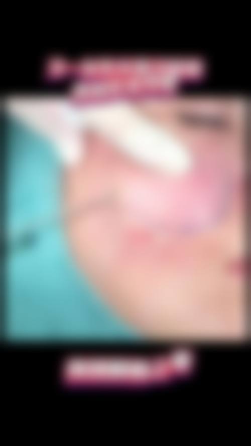 北海红粉丽人整形医院擅长项目