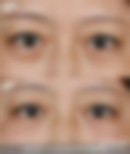 北海红粉丽人整形医院治疗反馈与口碑评价