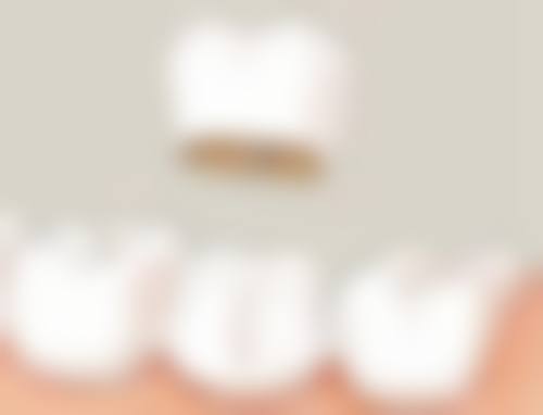 深圳王晶口腔诊所医生团队经验稳定。