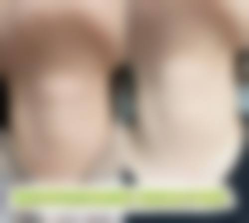 太原天泽丽人医疗美容诊所擅长项目。