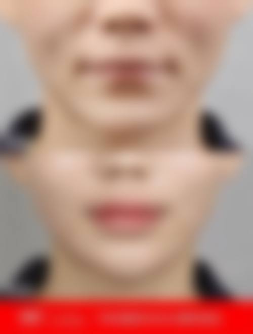 淮北相山天使整形医院预约挂号方式