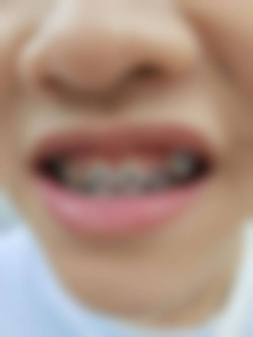 朔州颐美口腔医院擅长项目