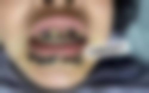 宣城德林口腔门诊部擅长项目。