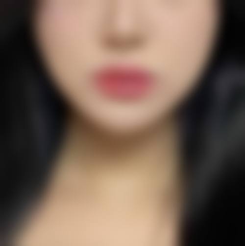 沈阳臻瑞恒美医疗美容门诊部医生团队经验稳定。