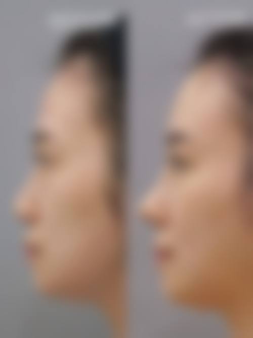 北京善尔医疗美容医院擅长项目