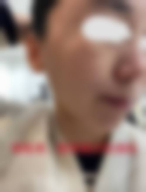 四川成都卓媛伊镁整形医院治疗反馈与口碑评价。