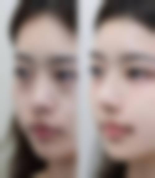 福州米兰医学美容门诊部医生团队经验稳定。