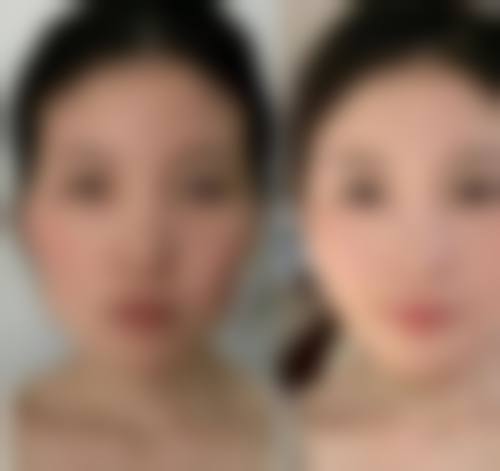 福州米兰医学美容门诊部擅长项目。