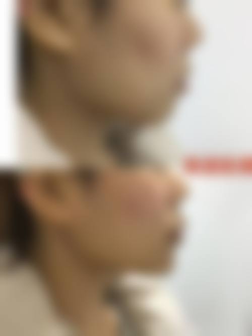 朱莎医生的技术实力