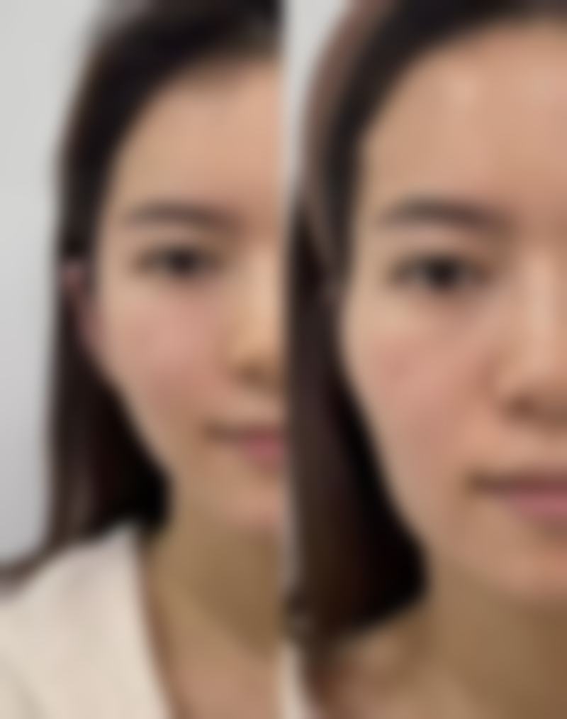 成都心悦容医疗美容医院项目价格
