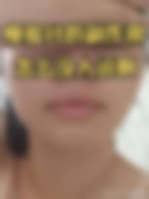 临沂高新技术产业开发区人民医院预约挂号方式。