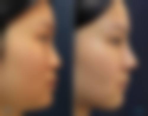 广州柏岁伊美整形医院擅长项目。