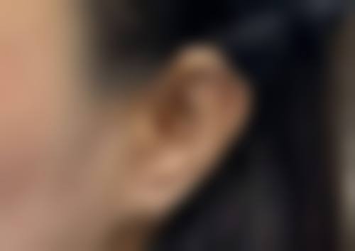 广州柏岁伊美整形医院治疗反馈与口碑评价。