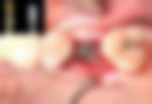 济南市中康尔博口腔门诊部治疗反馈与口碑评价。