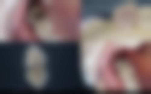 江苏苏州一口好牙口腔地理位置便于到院。