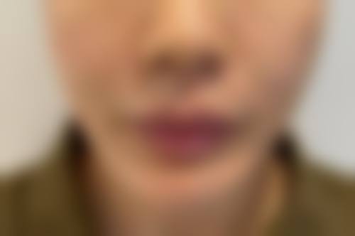 西安西美整形中 心的口碑评价