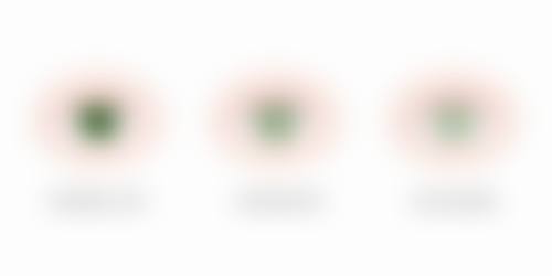 张采华擅长的眼科项目