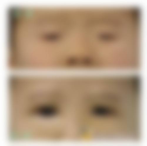 成都青羊品见眼视光擅长项目。