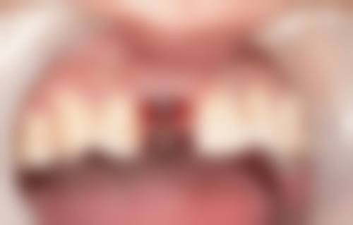 河南郑州艾薇口腔医生团队介绍