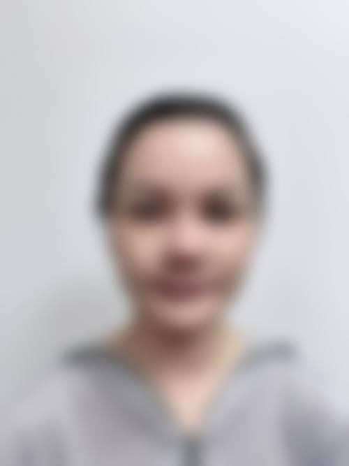成都高新色优美龄整形医院治疗反馈与口碑评价。