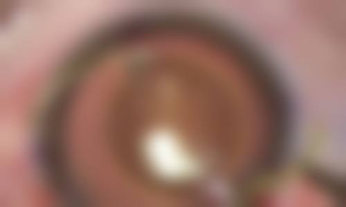 佛山市雅科眼科诊所有限公司三水医视诊所地理位置便于到院。