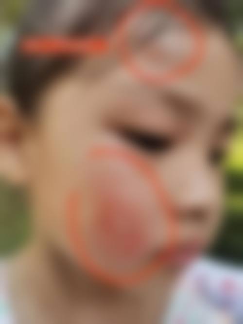 广元小青草眼科医院门诊营业时间。