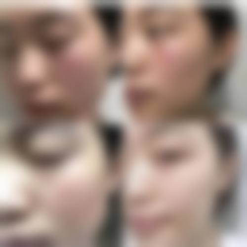 成都高新色优美龄整形医院擅长项目。